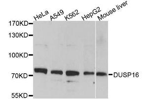 Western blot analysis of extracts of various cell lines, using DUSP16 antibody. (DUSP16 抗体  (AA 416-665))