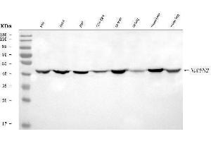 Western blot analysis of NDUFS2 using anti-NDUFS2 antibody (ABIN7599417).