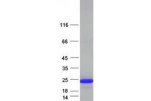 Validation with Western Blot (NUDT3 Protein (Myc-DYKDDDDK Tag))