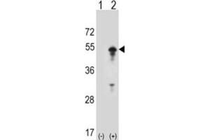 Western Blotting (WB) image for anti-Signal Transducing Adaptor Molecule (SH3 Domain and ITAM Motif) 1 (STAM) antibody (ABIN3001494)