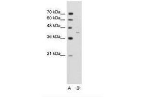 Image no. 1 for anti-GNAS Complex Locus (GNAS) (AA 297-346) antibody (ABIN203496) (GNAS 抗体  (AA 297-346))