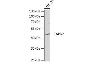 Western blot analysis of extracts of HT-29 cells using TAPBP Polyclonal Antibody at dilution of 1:1000. (TAPBP 抗体)