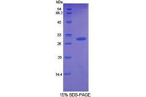 SDS-PAGE analysis of Rat GDF11 Protein. (GDF11 蛋白)