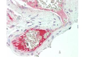 Human Colon, Vessel: Formalin-Fixed, Paraffin-Embedded (FFPE). (F13B 抗体  (AA 216-265))