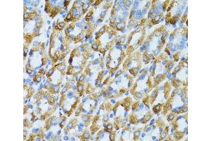 Immunohistochemistry of paraffin-embedded Mouse stomach using PSRC1 Polyclonal Antibody at dilution of 1:100 (40x lens). (PSRC1 抗体)