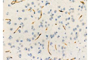 ABIN6264216 and ABIN6273297 at 1/100 staining Rat brain tissue by IHC-P. (PIK3IP1 抗体  (N-Term))