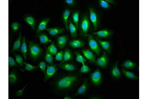 Immunofluorescence staining of A549 cells with ABIN7160061 at 1:133, counter-stained with DAPI. (MAP3K9 抗体  (AA 864-1098))