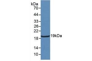 Detection of Recombinant IL18, Rat using Monoclonal Antibody to Interleukin 18 (IL18) (IL-18 抗体  (AA 37-194))