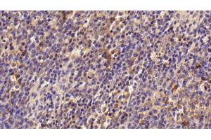 Detection of TGM2 in Human Spleen Tissue using Polyclonal Antibody to Transglutaminase 2 (TGM2)