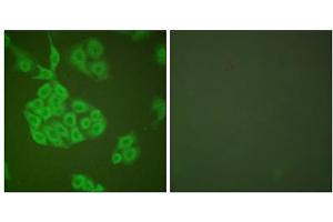 Immunofluorescence analysis of A549 cells, using MMP11 antibody (ABIN5976457). (MMP11 抗体  (Internal Region))