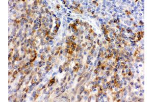 Anti- CD62P Picoband antibody, IHC(P) IHC(P): Human Tonsil Tissue (P-Selectin 抗体  (AA 42-271))