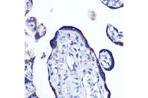 Immunohistochemistry of paraffin-embedded human placenta using Alkaline Phosphatase (ALPL) (ALPL) Rabbit mAb (ABIN7265551) at dilution of 1:100 (40x lens). (ALPL 抗体)