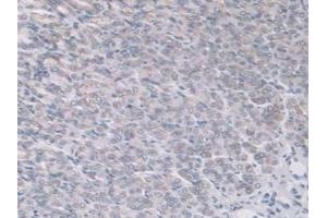 Immunohistochemistry (IHC) image for anti-ADAM Metallopeptidase with Thrombospondin Type 1 Motif, 7 (ADAMTS7) (AA 226-437) antibody (ABIN7437842)