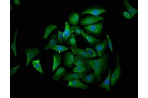 Immunofluorescence (IF) image for anti-CASP2 and RIPK1 Domain Containing Adaptor with Death Domain (CRADD) (AA 1-199) antibody (ABIN7149542)