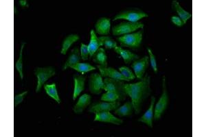 Immunofluorescence staining of A549 cells with ABIN7149542 at 1:530, counter-stained with DAPI. (CRADD 抗体  (AA 1-199))