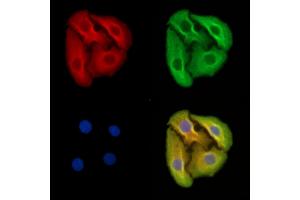 ABIN7095605 and ABIN7099667 staining Hela cells by IF/ICC. (HSC70 Interacting Protein HIP 抗体)