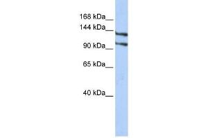 RBM5 antibody used at 1. (RBM5 抗体  (N-Term))