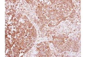 Image no. 1 for anti-Insulin Receptor (INSR) (AA 816-988) antibody (ABIN1498892) (Insulin Receptor 抗体  (AA 816-988))