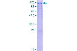 Image no. 1 for EPH Receptor A3 (EPHA3) (AA 1-983) protein (GST tag) (ABIN1352921)
