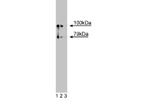 Western blot analysis of hCNK1 on a A431 cell lysate (Human epithelial carcinoma, ATCC CRL-1555). (CNKSR1 抗体  (AA 10-217))