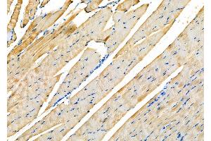 ABIN6258189 and ABIN6273887 at 1/100 staining Rat muscle tissue by IHC-P. (GPR63 抗体  (Internal Region))