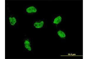 Immunofluorescence of monoclonal antibody to HOXA5 on HeLa cell. (HOXA5 抗体  (AA 171-270))