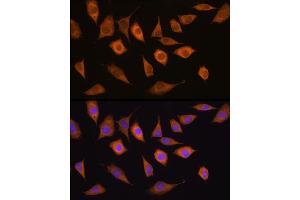 Immunofluorescence analysis of L929 cells using USP5 antibody (ABIN1683231, ABIN3018687, ABIN3018688 and ABIN6220542) at dilution of 1:100. (USP5 抗体  (AA 1-280))