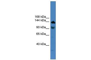 WB Suggested Anti-TLR8 Antibody Titration: 0.