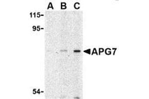 AP20056PU-N ATG7 antibody staining of L1210 cell lysate by Western Blotting at (A) 1, (B) 2 and (C) 4 μg/ml.