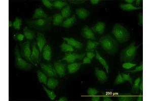 Immunofluorescence of monoclonal antibody to GLS on HeLa cell. (Glutaminase 抗体  (AA 580-669))