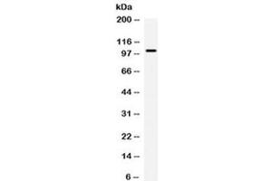 Western blot testing of human COLO320 cell lysate with Calpastatin antibody at 0. (Calpastatin 抗体  (AA 275-310))