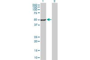 Western Blot analysis of NR0B1 expression in transfected 293T cell line by NR0B1 MaxPab polyclonal antibody. (NR0B1 抗体  (AA 1-470))