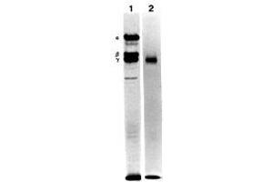 Immunoprecipitation of the culture medium of human pancreatic carcinoma cells (metabolically labeled with S35Ðmethionine) with MAb BC17 (Laminin g1) (Lane 1). (Laminin gamma 1 抗体)