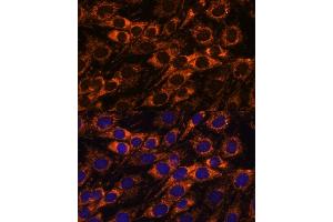 Immunofluorescence analysis of C6 cells using  antibody (ABIN7265368) at dilution of 1:100. (ACAA2 抗体  (AA 1-250))