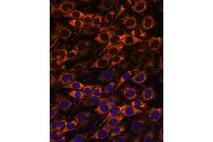 Immunofluorescence analysis of C6 cells using  antibody (ABIN7265368) at dilution of 1:100. (ACAA2 抗体  (AA 1-250))