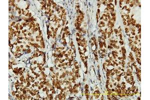Image no. 1 for anti-Non-SMC Condensin II Complex, Subunit D3 (NCAPD3) (AA 1-341) antibody (ABIN466186) (NCAPD3 抗体  (AA 1-341))