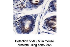 Image no. 2 for anti-Anterior Gradient Homolog 2 (Xenopus Laevis) (AGR2) (AA 50-100) antibody (ABIN363664) (AGR2 抗体  (AA 50-100))
