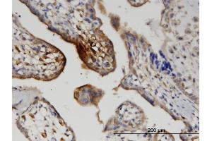 Immunostaining (ISt) image for anti-Wingless-Type MMTV Integration Site Family, Member 5A (WNT5A) (AA 201-300) antibody (ABIN521385)