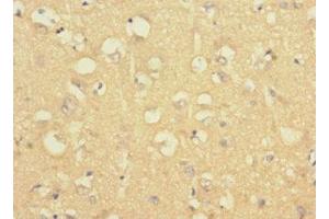 Immunohistochemistry of paraffin-embedded human brain tissue using ABIN7158190 at dilution of 1:100 (LRRC4C 抗体  (AA 201-500))