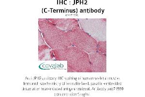 Image no. 2 for anti-Junctophilin 2 (JPH2) (C-Term) antibody (ABIN1736131) (Junctophilin 2 抗体  (C-Term))