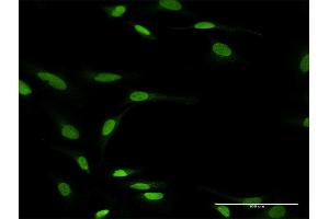Immunofluorescence of purified MaxPab antibody to ZNF71 on HeLa cell. (ZNF71 抗体  (AA 1-489))
