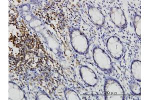 Immunostaining (ISt) image for anti-C-Src tyrosine Kinase (CSK) (AA 1-100) antibody (ABIN560501)