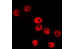 Immunofluorescence (fixed cells) (IF/ICC) image for anti-Inhibitor of DNA Binding 1, Dominant Negative Helix-Loop-Helix Protein (ID1) (Internal Region) antibody (ABIN6262441)