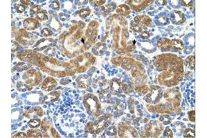 ATIC antibody was used for immunohistochemistry at a concentration of 4-8 ug/ml. (ATIC 抗体  (Middle Region))