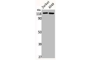 Western Blot analysis of Jurkat A549 cells using GCP5 Polyclonal Antibody (TUBGCP5 抗体  (Internal Region))