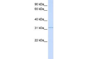 WB Suggested Anti-SUSD4 Antibody Titration:  0. (SUSD4 抗体  (N-Term))