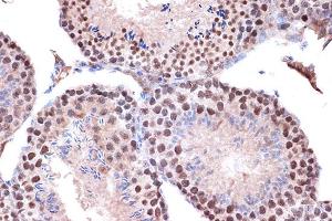 Immunohistochemistry (IHC) image for anti-Kinesin Family Member 4A (KIF4A) antibody (ABIN7268134)