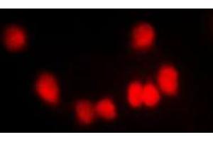 Immunofluorescent analysis of HKR1 staining in NIH3T3 cells. (HKR1 抗体  (Center))