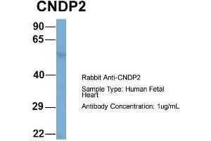 Host: Rabbit  Target Name: CNDP2  Sample Tissue: Human Fetal Heart  Antibody Dilution: 1. (CNDP2 抗体  (Middle Region))