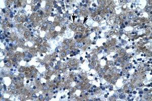Image no. 1 for anti-Suppressor of Ty 3 Homolog (SUPT3H) (AA 87-136) antibody (ABIN203052) (SUPT3H/SPT3 抗体  (AA 87-136))